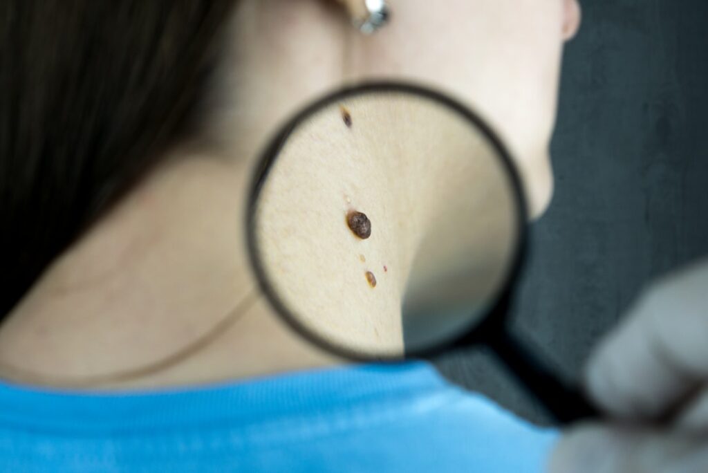 Dermatologist examining a patient's skin closely during a clinic consultation