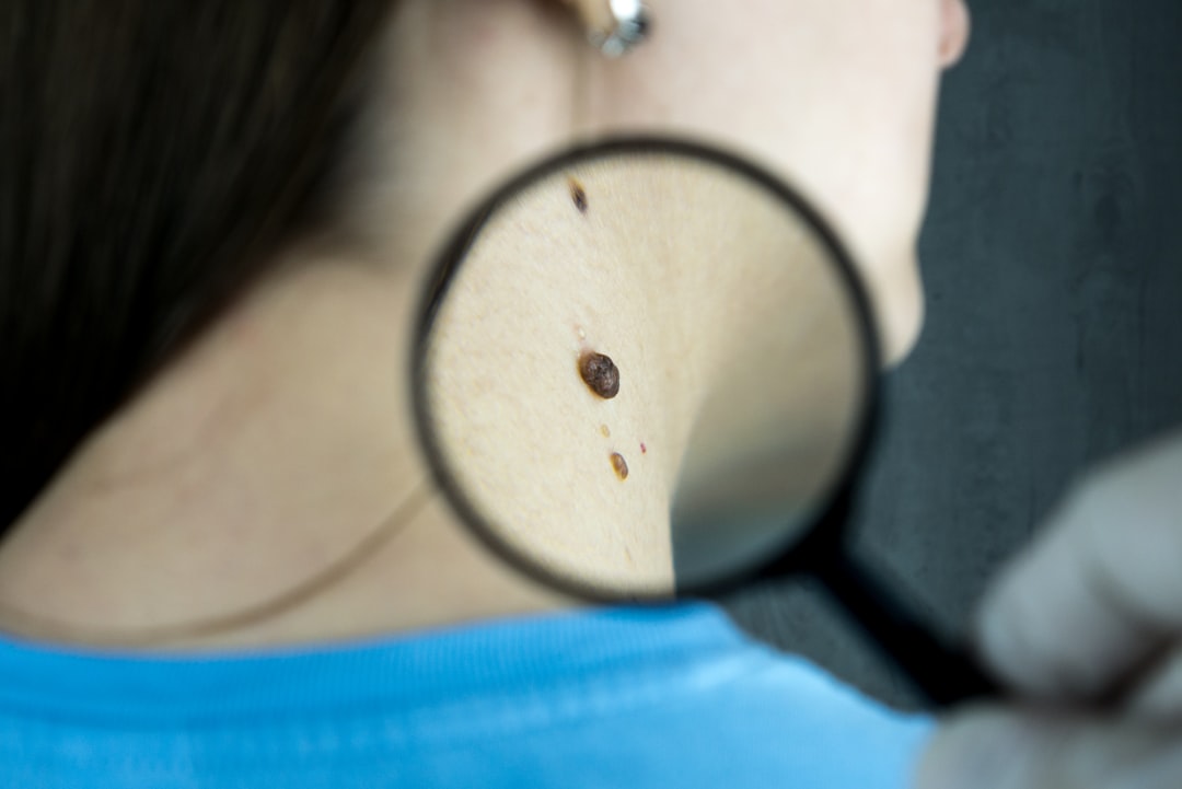 Dermatologist examining a patient's skin closely during a clinic consultation