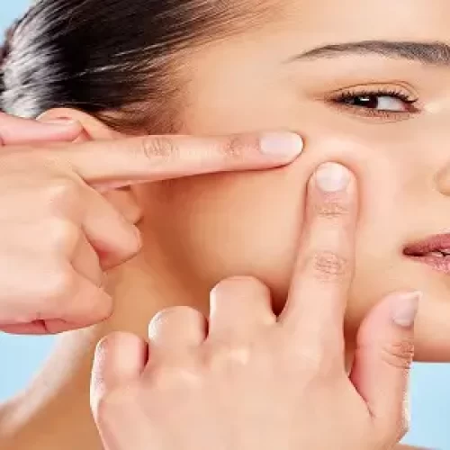 Studio portrait of an attractive young woman squeezing a zit on her face against a blue background.